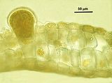 Sezione trasversale a livello di una tetrasporociste parzialmente immersa e provvista di una cellula basale sterile